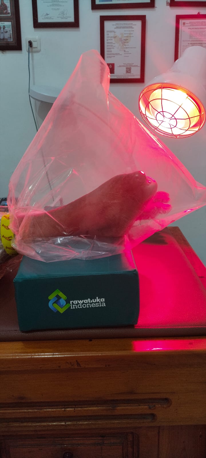 Pelayanan Terapi Luka dengan OZON dan INFRARED